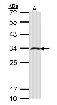 creatine kinase, mitochondrial 1B Antibody