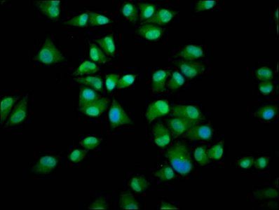 IMPDH1 Antibody