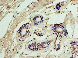 IMPDH2 Antibody