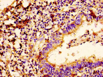 IMPDH2 Antibody