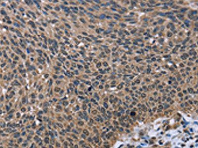 IMPDH2 Antibody