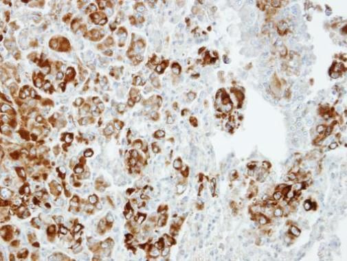 Importin 13 antibody [C3], C-term