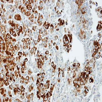 Importin 13 antibody