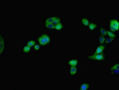 Indian hedgehog protein antibody