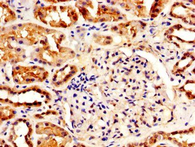 IHH Antibody