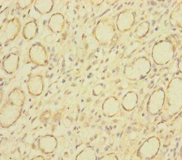 Indian hedgehog protein antibody