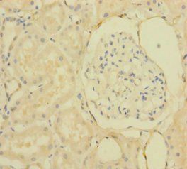 IHH Antibody