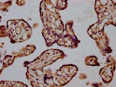 INF2 Antibody