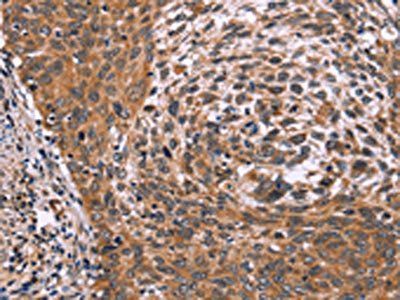 ING2 Antibody