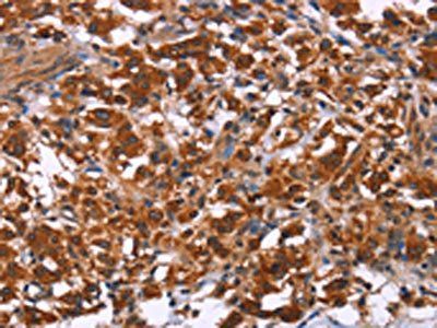 ING2 Antibody