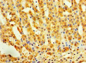 INHBA Antibody