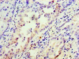 INHBA Antibody