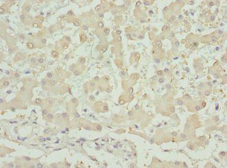 INHBB Antibody