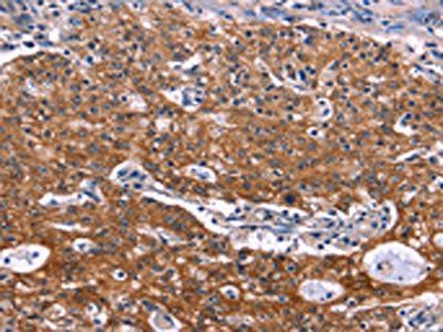 NOS2 Antibody