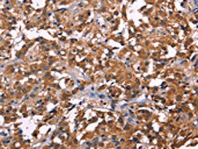 NOS2 Antibody