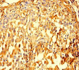 IMPDH2 Antibody
