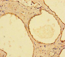 Inosine-5'-monophosphate dehydrogenase 2 antibody