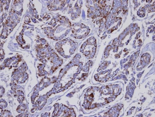INPP1 antibody [N1C2]