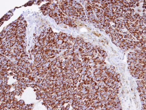 INPP1 antibody [N1C2]