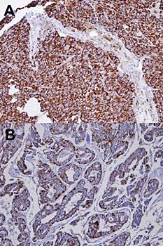 INPP1 antibody