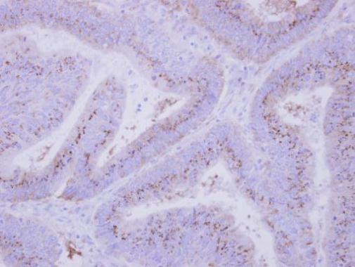 INPP5F antibody