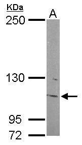 inositol polyphosphate-5-phosphatase F Antibody