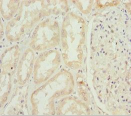 INPP5K Antibody