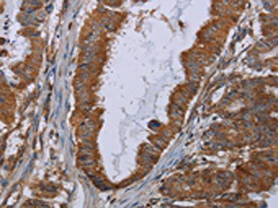 INSIG2 Antibody
