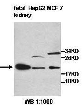 INSL6 Rabbit Polyclonal Antibody