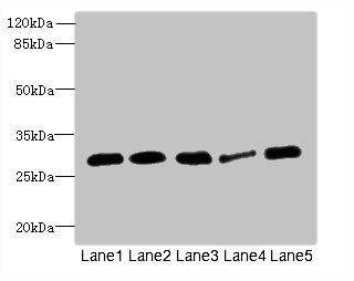 IGFBP1 Antibody