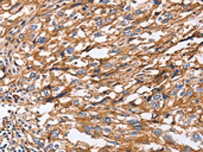 ITGB1 Antibody