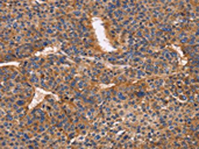ITGB1 Antibody