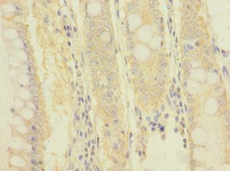 ITGB7 Antibody