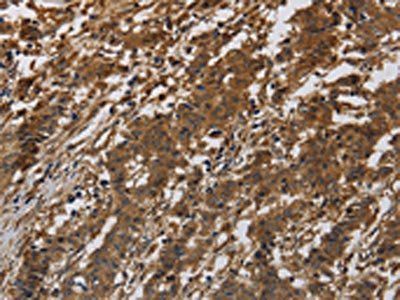ITGB7 Antibody