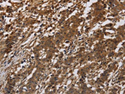 Integrin beta 7 antibody