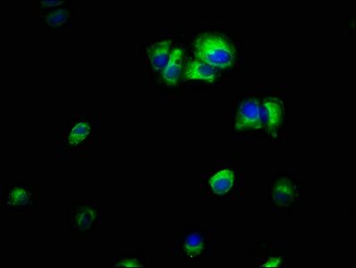 Integrin-linked protein kinase antibody