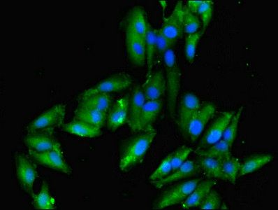 ILK Antibody