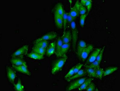 Integrin-linked protein kinase antibody