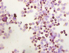 ILK Antibody