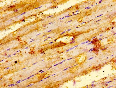 ILK Antibody