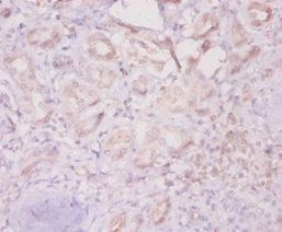 ILK Antibody