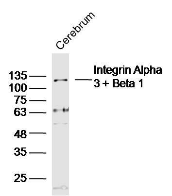 Integrin Alpha 3 + Beta 1 antibody