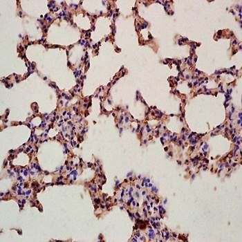 Integrin alpha 4+Beta 7 Rabbit Polyclonal Antibody