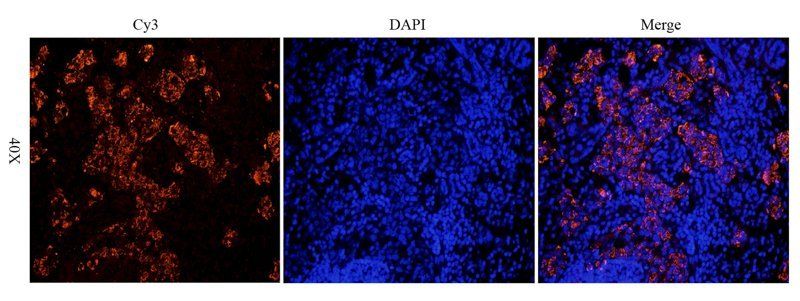 Integrin alpha 4 antibody