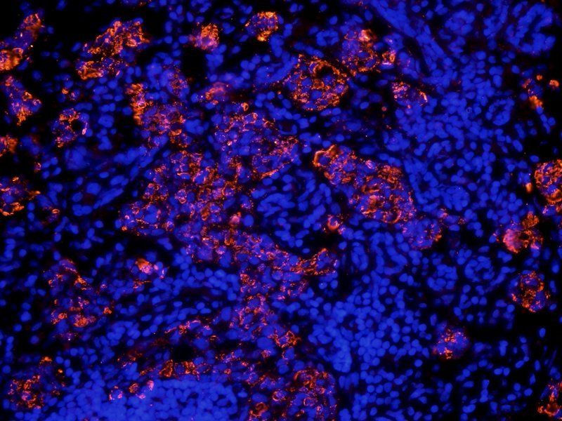 Integrin alpha 4 antibody