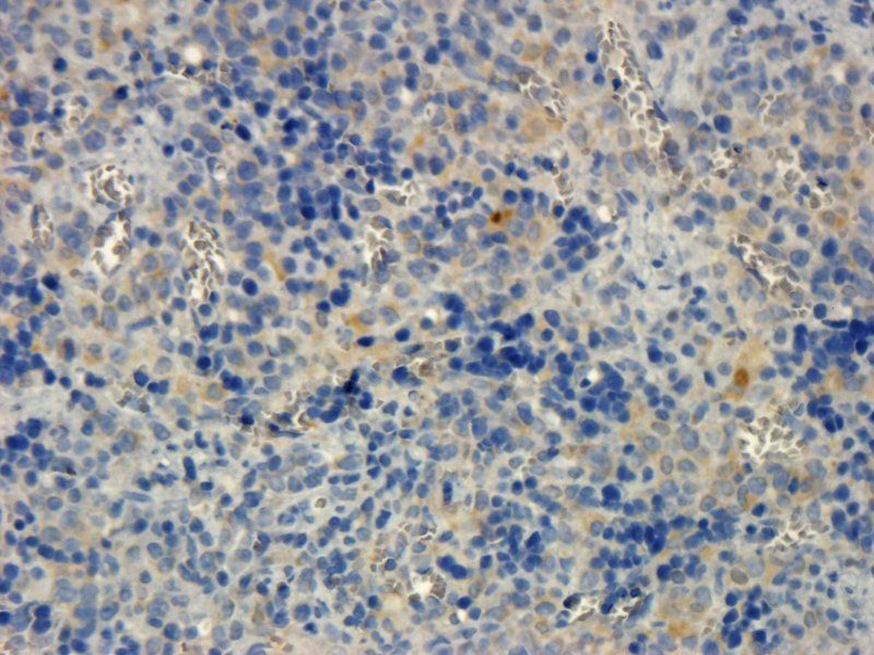 Integrin alpha 4 antibody