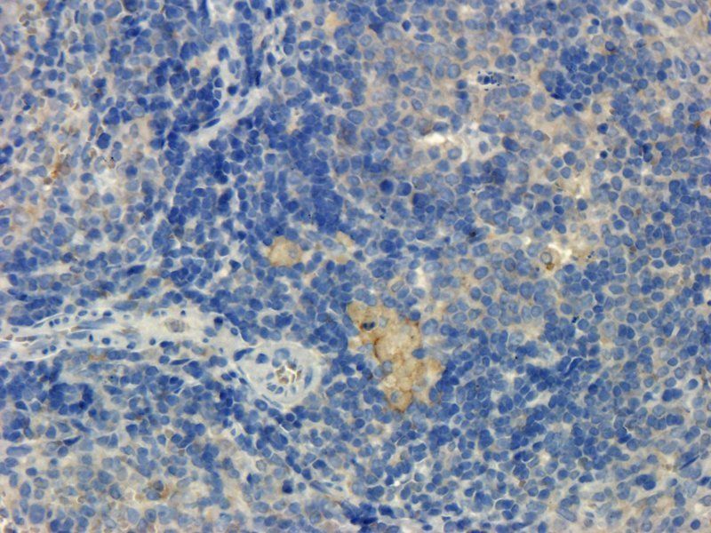 Integrin alpha 4 antibody