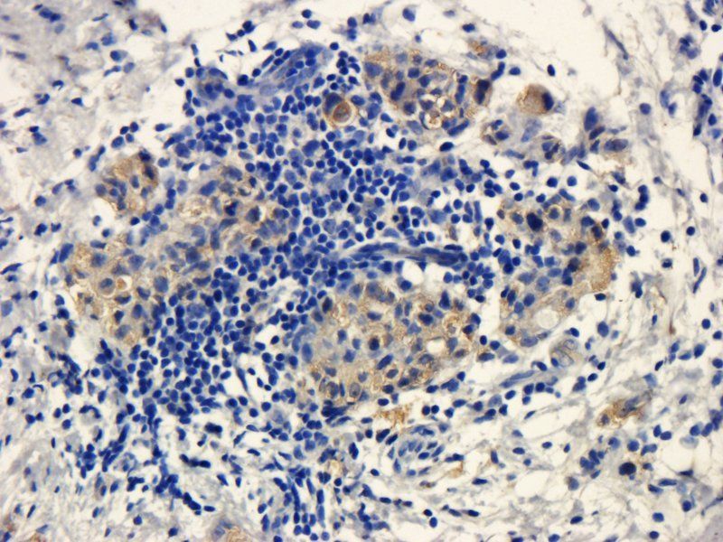 Integrin alpha 4 antibody