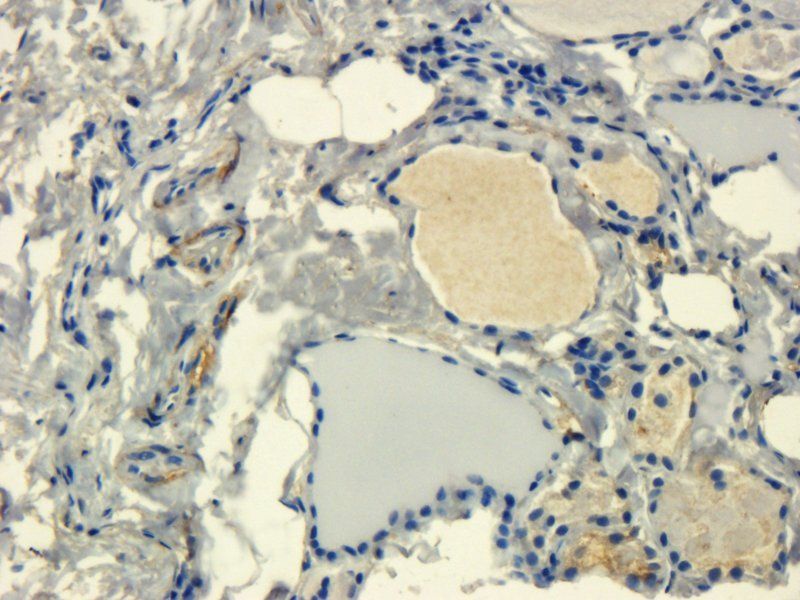 Integrin alpha 4 antibody