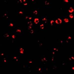 Integrin alpha 4 Antibody
